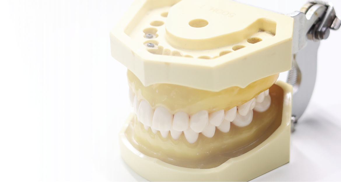 人工歯（上部構造）の製作・装着
